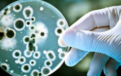 TEST - Habe ich Candida? TEST - Habe ich Candida?