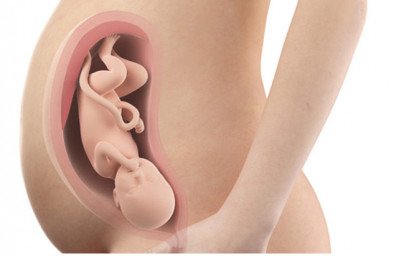 35. týždeň tehotenstva 35. týždeň tehotenstva